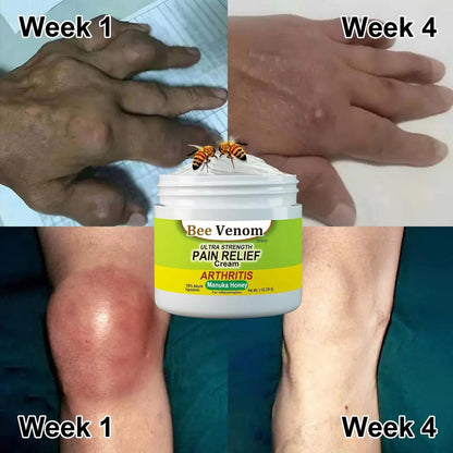 ORIGINAL™ BEE VENOM JOINT AND BONE THERAPY CREAM  BUY 1 GAT 2 FREE